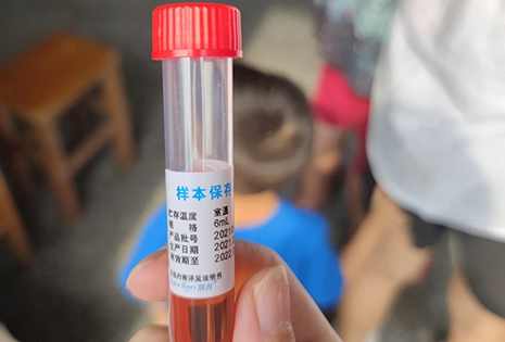 病毒采集管項(xiàng)目詳情